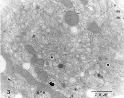 MITOCONDRIAS (HIGADO DE BATRACIO)