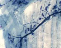 TERMINACIONES DE NERVIO MOTOR DECONEJO, M.E.