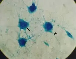 MOTONEURONA, M.E.* 7375.020